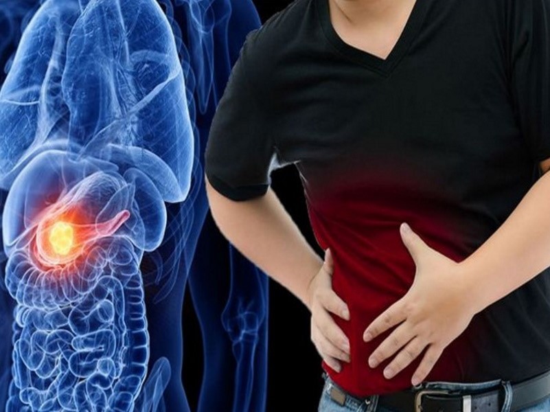 از علائم سرطان پانکراس، درد در یک طرف پهلو و شکم است
