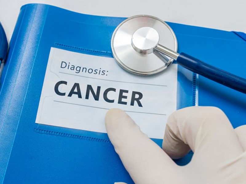تشخیص به موقع سرطان، در درمان آن بسیار موثر است