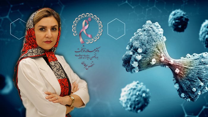 بهترین متخصص سرطان سینه در تهران و درمان سرطان سینه