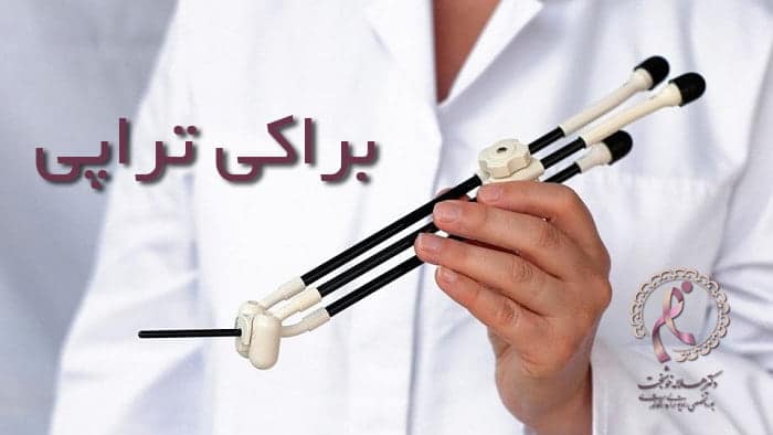 رادیوتراپی یکی از روشهای موثر و متداول درمان سرطان است که باعث نگرانی بسیاری از خانواده ها نسبت به ایمنی اطرافیان بیمار میشود. در این مقاله بهطور علمی بررسی میشود که آیا پس از ایا رادیوتراپی خطرناک است ؟ خطرات پرتودرمانی برای اطرافیان. قطعا بی خطر است! پاسخ اصلی به این دغدغه مهم را خواهید خواند و توصیههای کاربردی را فرا خواهید گرفت. براکی تراپی